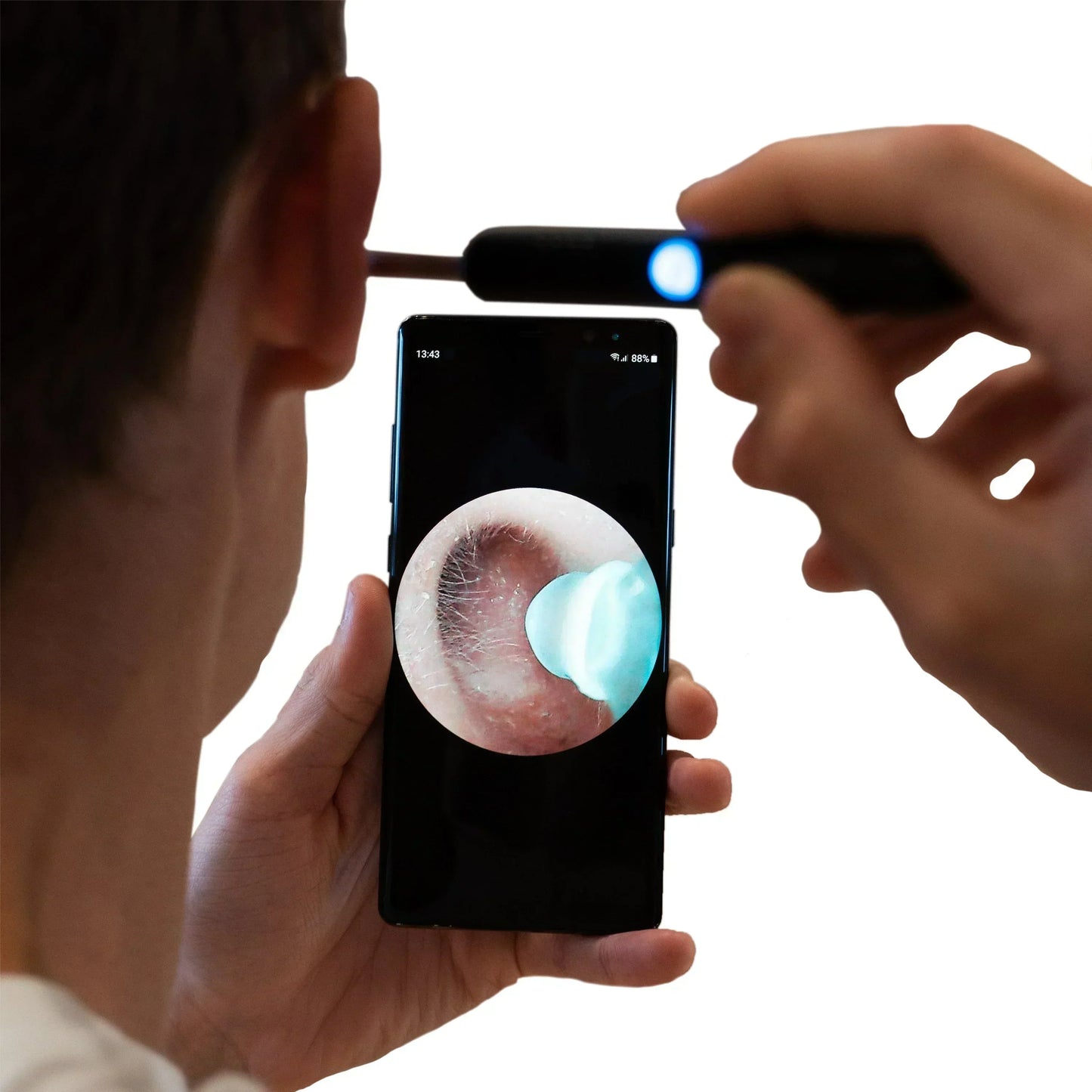 LUMORA™ - PROFESSIONAL EAR WAX REMOVAL TOOL