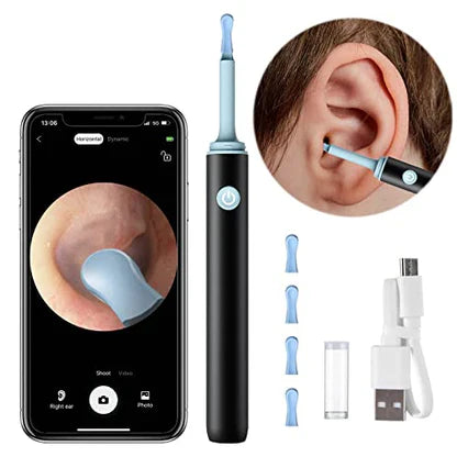 LUMORA™   - PROFESSIONAL EAR WAX REMOVAL TOOL